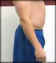 Anterior_Pelvic_Tilt.webp Anterior_Pelvic_Tilt.webp