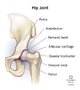 Thread 'Steroid hip issues?'