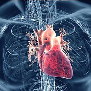 What Causes Heart Disease?